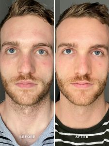 ALPHA-H Vitamin B Serum