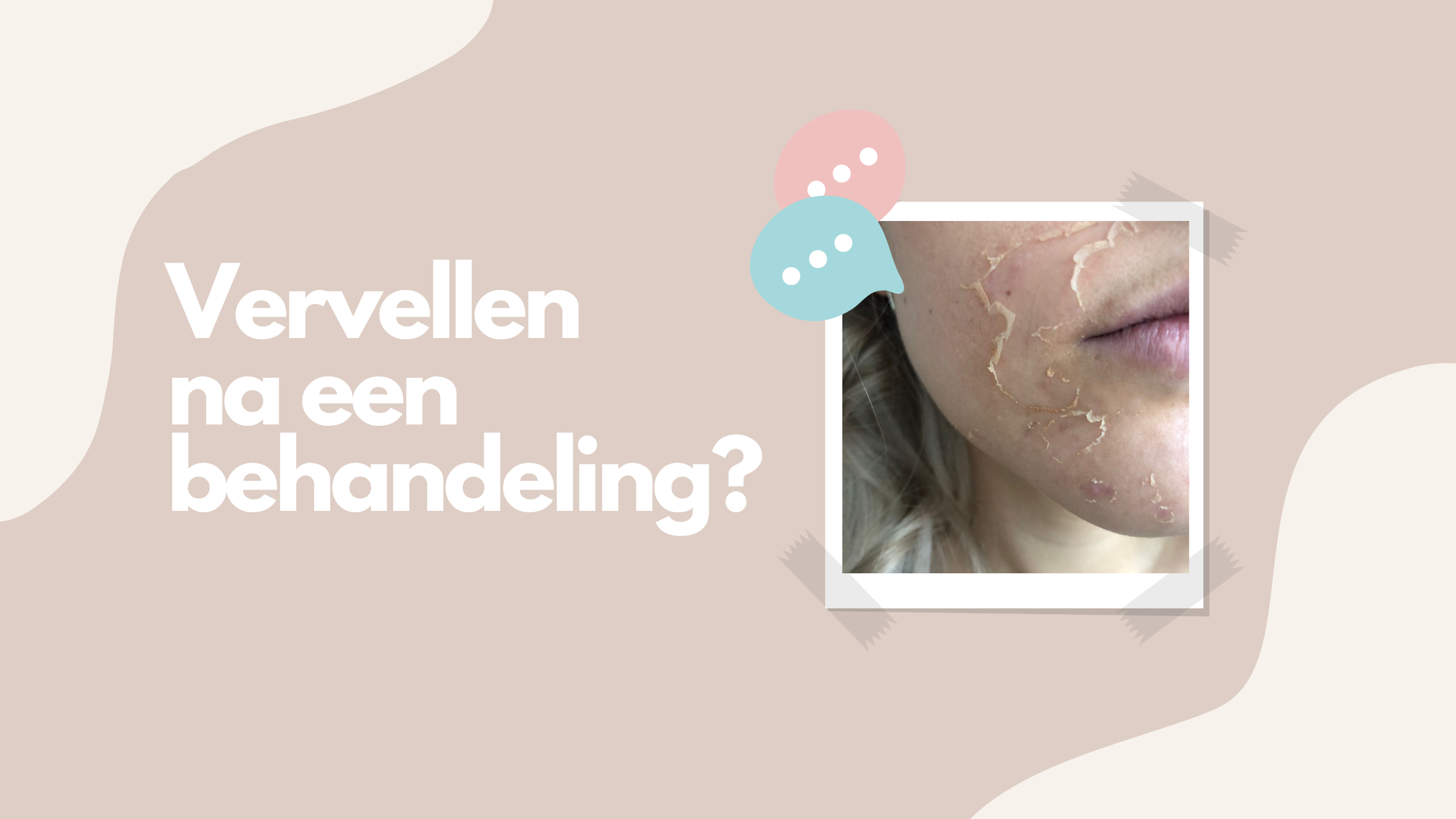 Vervellen na een huidbehandeling 
